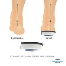 Load image into Gallery viewer, Tuli’s Plantar Fasciitis Insoles pronation