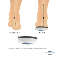 Load image into Gallery viewer, Tuli’s Plantar Fasciitis Insoles pronation
